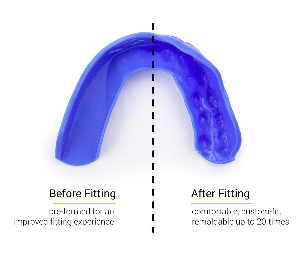 SISU 3D Adult Custom Fit Mouthguard - view 2